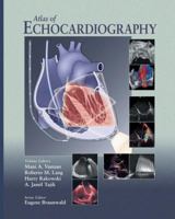 Atlas of Echocardiography 1573402176 Book Cover