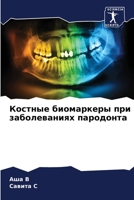 Костные биомаркеры при заболеваниях пародонта 6205394944 Book Cover