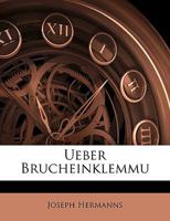 Ueber Brucheinklemmu 117422844X Book Cover