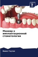 Маневр к имплантационно& 620739447X Book Cover