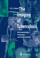 The Imaging of Tuberculosis: With Epidemiological, Pathological, and Clinical Correlation 3642626106 Book Cover