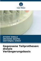 Gegossene Teilprothesen: distale Verlängerungsbasis (German Edition) 663032627X Book Cover