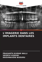 L'Imagerie Dans Les Implants Dentaires (French Edition) 6207204417 Book Cover