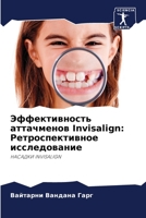 Эффективность аттачменов Invisalign: Ретроспективное исследование: НАСАДКИ INVISALIGN 6206094588 Book Cover