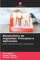 Biomecânica de implantes: Princípios e Aplicações (Portuguese Edition) 6209538584 Book Cover