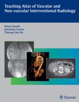 Teaching Atlas of Vascular and Non-vascular Interventional Radiology 313144181X Book Cover