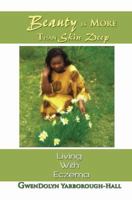 Beauty Is More Than Skin Deep: Living With Eczema 1564115097 Book Cover