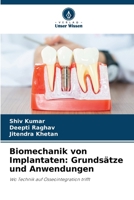 Biomechanik von Implantaten: Grundsätze und Anwendungen (German Edition) 6209431461 Book Cover