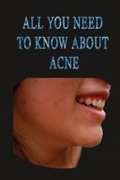 All you need to know about acne: causes and treatments of acne stages solutions natural remedies B08GLQY56H Book Cover