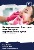 Вилкодонтикс: Быстрее, чем быстрое перемещение зубов: Ускоренная ортодонтия 6206092364 Book Cover