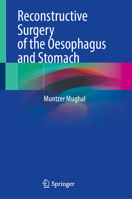 Reconstructive Surgery of the Oesophagus and Stomach 3031668456 Book Cover