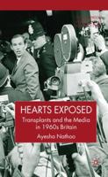 Hearts Exposed: Transplants and the Media in 1960s Britain 1349541354 Book Cover