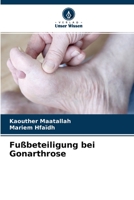 Fu�beteiligung bei Gonarthrose 6204116452 Book Cover