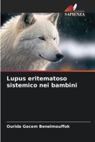 Lupus eritematoso sistemico nei bambini (Italian Edition) 6207028384 Book Cover
