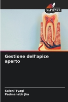 Gestione dell'apice aperto (Italian Edition) 6207673344 Book Cover