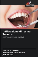 Infiltrazione di resina Tecnica: UN APPROCCIO MICRO-INVASIVO 620415382X Book Cover