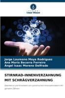 Stirnrad-Innenverzahnung Mit Schrägverzahnung (German Edition) 6208490383 Book Cover