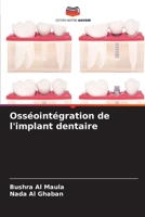 Osséointégration de l'implant dentaire (French Edition) 6208060583 Book Cover