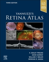 Yannuzzi's Retina Atlas 0443112169 Book Cover