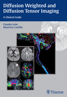 Diffusion Weighted and Diffusion Tensor Imaging: A Clinical Guide 1626230218 Book Cover
