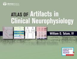 Atlas of Artifacts in Clinical Neurophysiology 0826169341 Book Cover