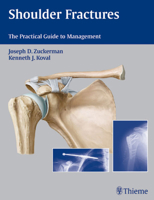 Shoulder Fractures: The Practical Guide To Management 1588903109 Book Cover