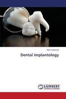 Dental implantology 3659512826 Book Cover