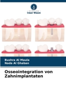 Osseointegration von Zahnimplantaten (German Edition) 6208060567 Book Cover