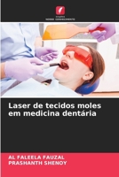 Laser de tecidos moles em medicina dentária (Portuguese Edition) 6207630157 Book Cover