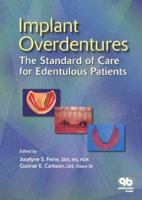 Implant Overdentures: The Standard of Care for Edentulous Patients 0867154306 Book Cover