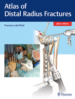 Atlas of Distal Radius Fractures 1498775403 Book Cover
