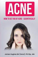 Acne: How to get rid of acne - scientifically 1974054675 Book Cover