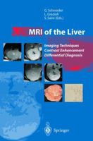 Mri Of The Liver: Imaging Techniques, Contrast Enhancement, Differential Diagnosis 8847002095 Book Cover