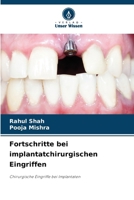 Fortschritte bei implantatchirurgischen Eingriffen: Chirurgische Eingriffe bei Implantaten 6207635213 Book Cover