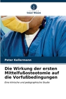 Die Wirkung der ersten Mittelfußosteotomie auf die Vorfußbedingungen 6202750707 Book Cover
