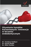 Ozywienie kanalów korzeniowych: Innowacje w leczeniu endodontycznym (Polish Edition) 6209947557 Book Cover