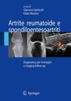 Artrite Reumatoide E Spondiloentesoartriti 8847006856 Book Cover