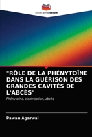 Rôle de la Phénytoïne Dans La Guérison Des Grandes Cavités de l'Abcès 6202730153 Book Cover