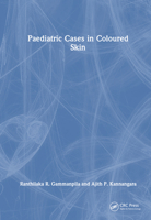 Paediatric Cases in Coloured Skin 1032343168 Book Cover