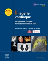 Imagerie cardiaque: Imagerie en coupes : scanner, IRM (French Edition) 2294767233 Book Cover