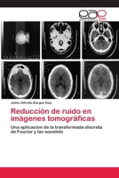Reduccion de Ruido En Imagenes Tomograficas 3659045705 Book Cover