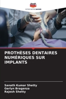 Prothèses Dentaires Numériques Sur Implants (French Edition) 6630569407 Book Cover