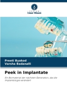 Peek in Implantate 620909161X Book Cover