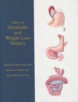 Atlas of Metabolic and Weight Loss Surgery 0978889088 Book Cover