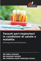 Tessuti peri-implantari in condizioni di salute e malattia (Italian Edition) 6209728588 Book Cover