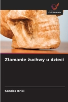 Zlamanie zuchwy u dzieci 6209116345 Book Cover