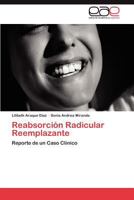 Reabsorcion Radicular Reemplazante 3844349626 Book Cover