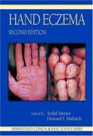 Hand Eczema 0849373557 Book Cover