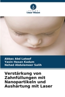 Verstärkung von Zahnfüllungen mit Nanopartikeln und Aushärtung mit Laser (German Edition) B0CK3QCZ6D Book Cover