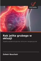 Rak jelita grubego w okluzji (Polish Edition) 6209510914 Book Cover